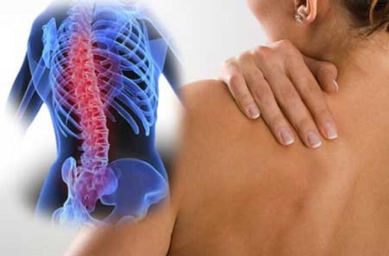 Back pain occurs during exacerbation of osteochondrosis of the thoracic spine. 