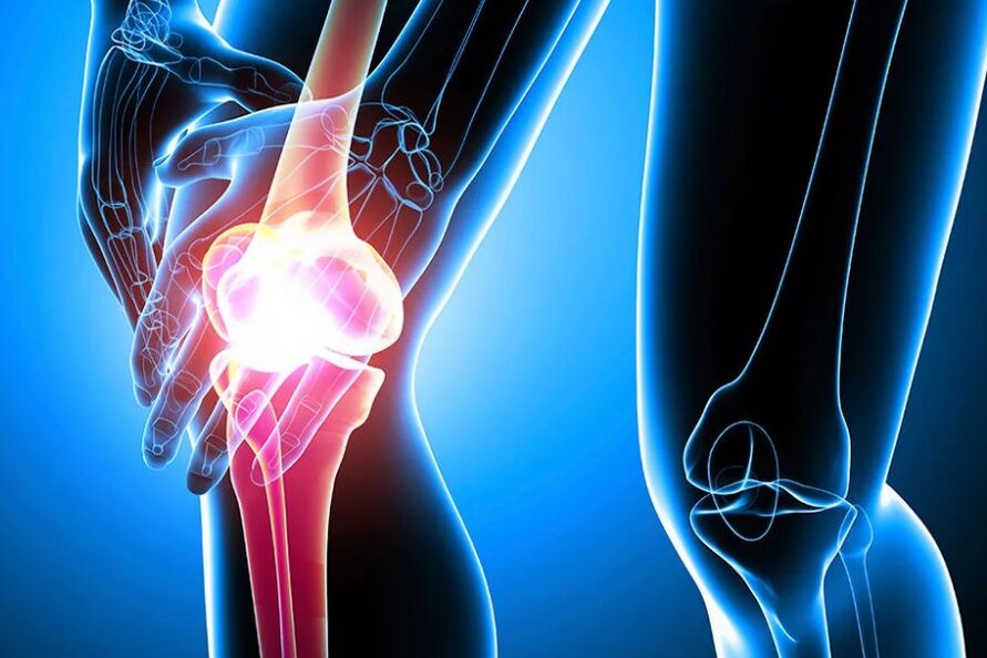 Arthaz of the knee