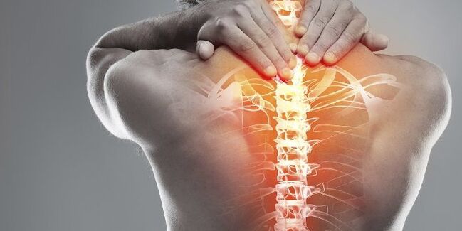 Medical options for cervical osteocondrosis cervical therapy