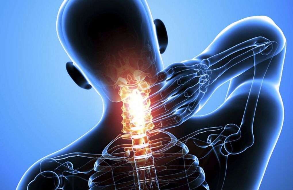 Osteocondrosis of cervical waist